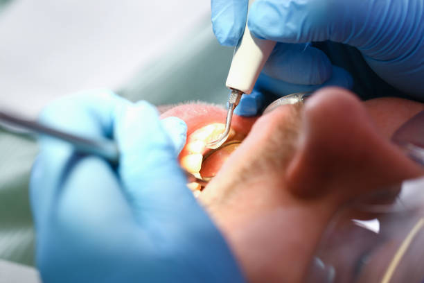 Best Emergency Treatment for Jaw Pain or Injury in Balch Springs, TX