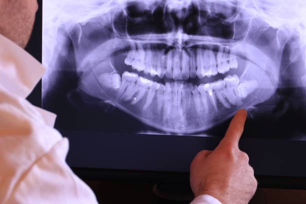 Best Walk-In Emergency Dental Services in Balch Springs, TX