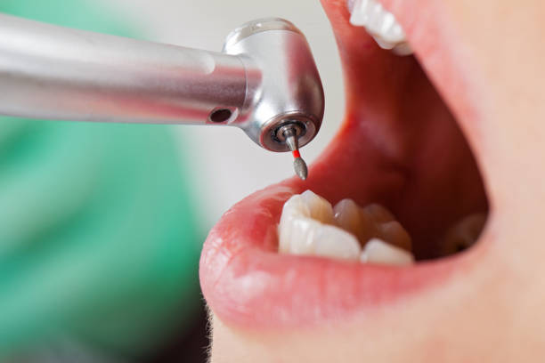 Best 24-Hour Emergency Dental Care in Balch Springs, TX